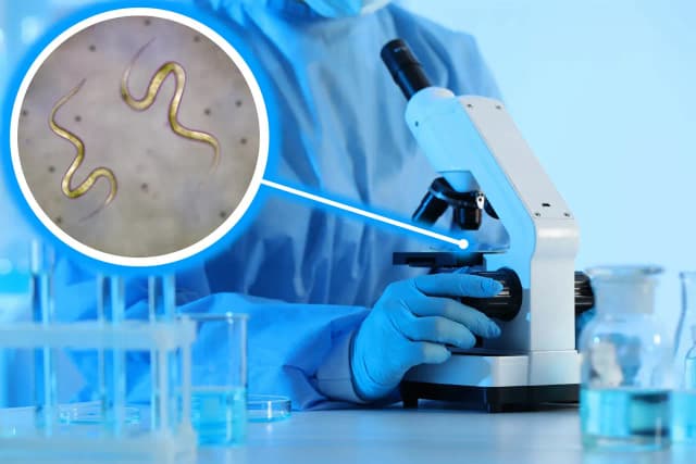 Ile daje się kału do badania? Kluczowe informacje, które musisz znać